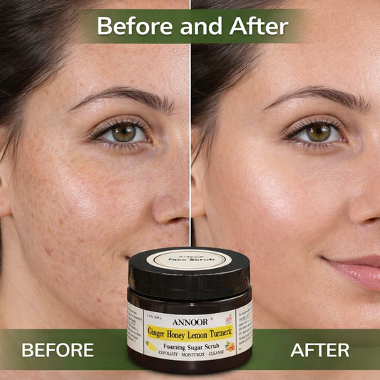 Annoor Foaming Sugar Scrub – Ginger Honey Lemon Turmeric - Gentle Exfoliation (6.5 oz / 185 g)