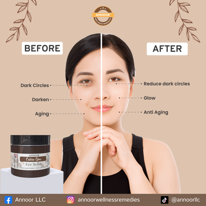 ANNOOR Coffee Glow Eye Scrub – Dark Circle Reducer | Anti-Aging & Brightening Formula for a Radiant Glow